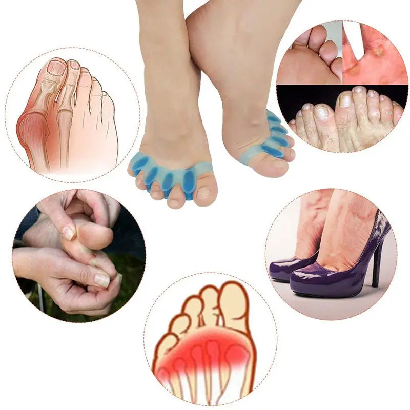 AlignEase® – Soft Gel Bunion Corrector & - Vista 3 del producto
